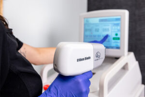 A Karma Beauty & Wellness provider adjusts the intensity of our device to customize laser hair reduction in Lee's Summit.